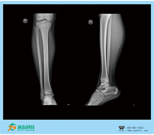 數字影像云膠片：未來醫學影像的顛覆者